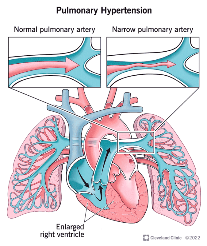 hipertensiune pulmonara caini