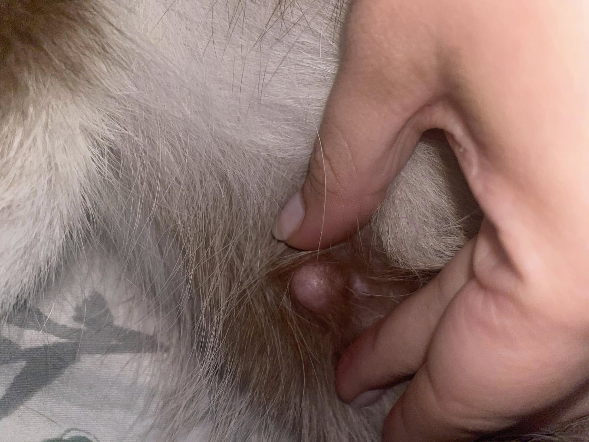 hernie ombilic caine